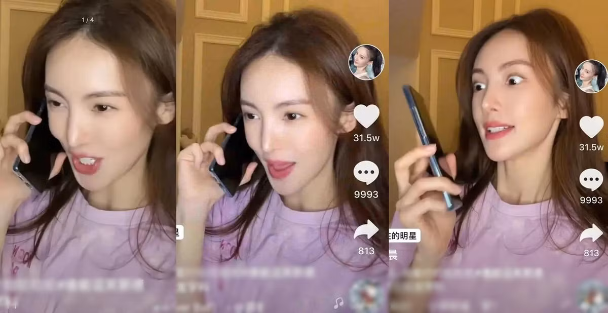 Bi kich nhung nguoi dep noi tieng phau thuat tham my hong-Hinh-7