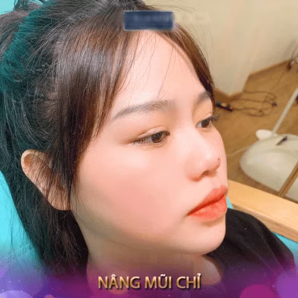 Xon xao hinh anh nguoi yeu Quang Hai nang mui, sua mat