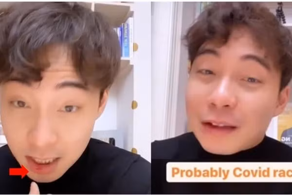 Vi la nguoi chau A nen nam vlogger bi dan mang dam vao mat?