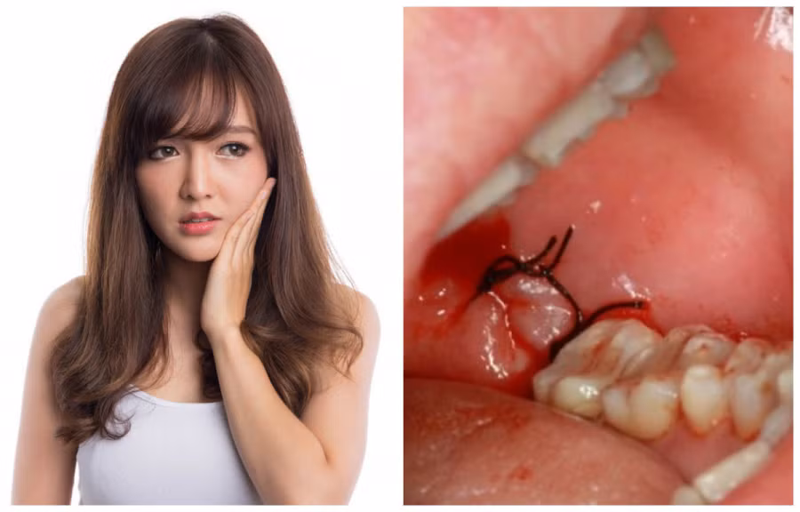 Không nhổ răng vào những thời điểm này kẻ mang họa Khong nho rang vao nhung thoi diem nay ke mang hoa