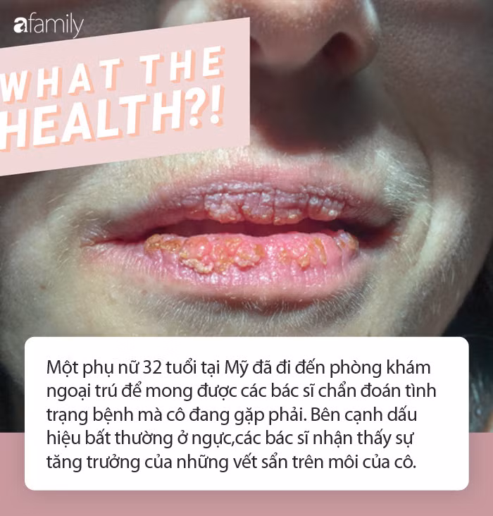 Khi môi xuất hiện điều bất thường này, hãy cẩn trọng Khi moi xuat hien dieu bat thuong nay, hay can trong