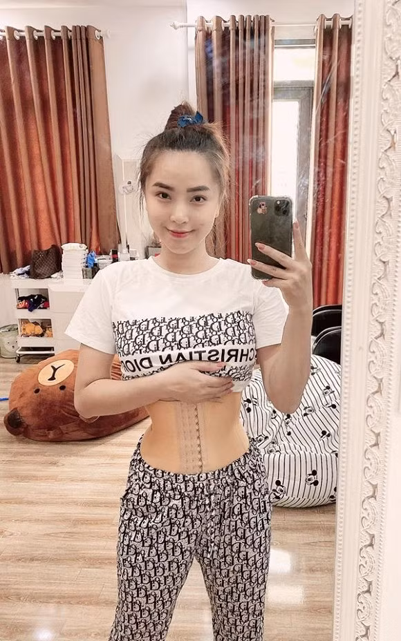 Hải Băng hé lộ hình ảnh bụng chằng chịt vết rạn sau 3 lần sinh - Hình 4 Hai Bang he lo hinh anh bung chang chit vet ran sau 3 lan sinh-Hinh-4