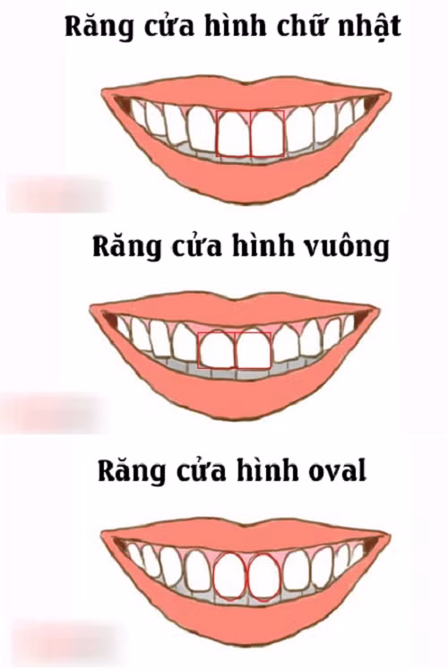 Nhìn điểm này đoán ngay vận mệnh giàu sang hay khốn khó - Hình 2 Nhin diem nay doan ngay van menh giau sang hay khon kho-Hinh-2