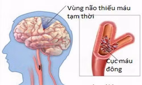 Ảnh minh họa Ảnh minh họa