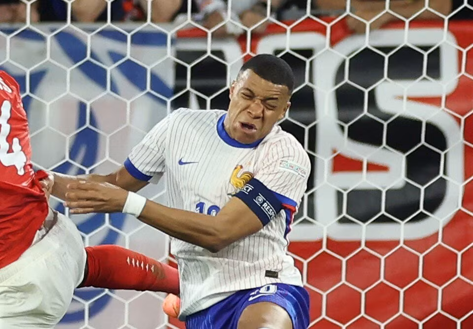 Mbappe bi gay mui, bo ngo kha nang ra san tran sau-Hinh-2