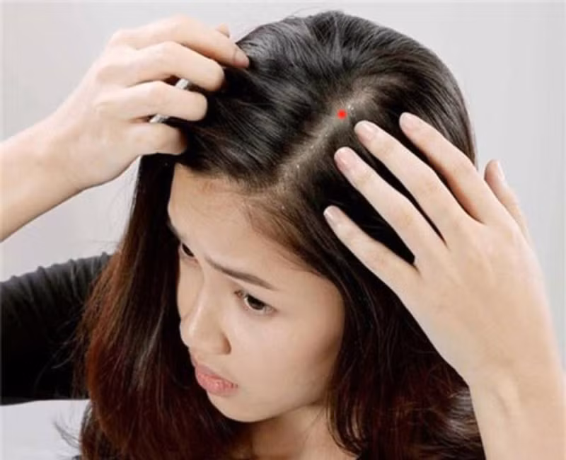 6. Có nốt ruồi trên tóc: Phụ nữ có nốt ruồi trên tóc, phần đẹp nhất ở trên đỉnh đầu thì thường giàu có, lấy được chồng, hôn nhân tốt. Hoặc bạn có thể được sinh ra với sự may mắn và có một nền tảng tương đối lý tưởng. 