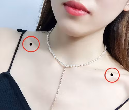 Nốt ruồi ở xương đòn. Phụ nữ có nốt ruồi trên xương đòn là người sống nặng tình, biết quan tâm đến người khác. Họ là những người có trái tim nhân hậu, tấm lòng bao dung. 
