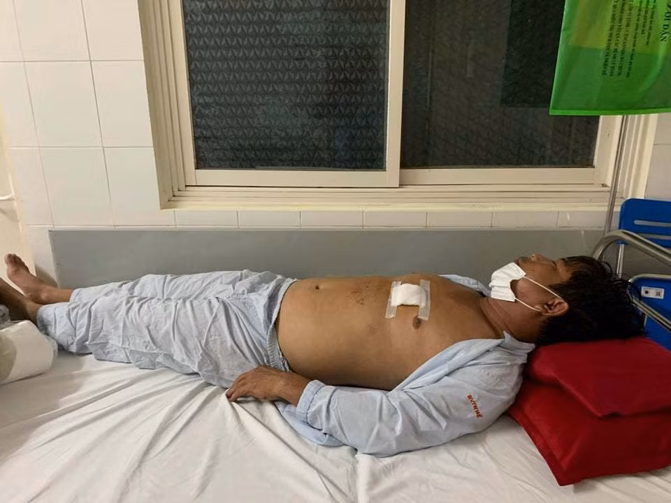 Mau thuan tac dat, anh trai dung keo dam em nhap vien-Hinh-2