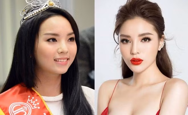Kỳ Duyên - Hoa hậu Việt Nam 2014 - cũng từng vướng nhiều nghi vấn phẫu thuật thẩm mỹ, khi gương mặt lạ hoắc so với thời điểm đăng quang.