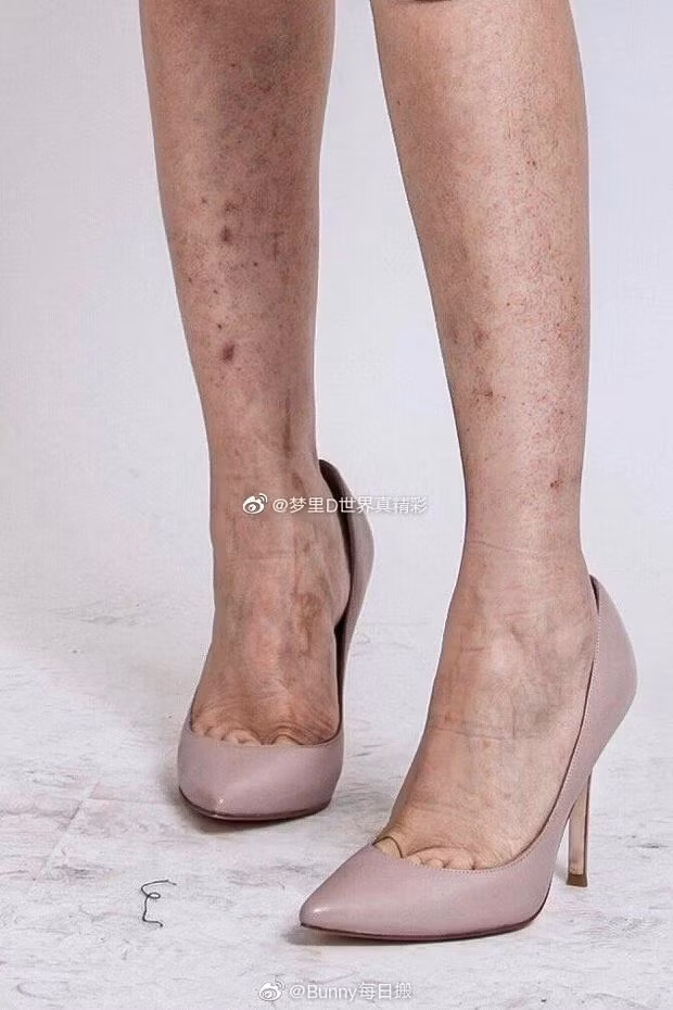 Cận cảnh đôi chân đầy khuyết điểm của mỹ nhân đứng top Trung Quốc. Rất nhiều những vết thâm, sứt sẹo nổi rõ trên da Nhiệt Ba khiến netizen ngỡ ngàng.