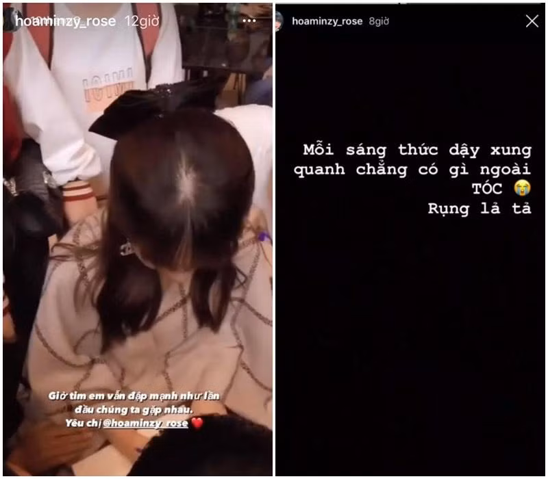 Ảnh trái cho thấy nỗi niềm bao năm qua của ca sĩ Hòa Minzy là thật khi phải chịu cảnh tóc rụng từng mảng đến lộ cả da đầu, và cho đến hiện tại vẫn chưa có dấu hiệu cải thiện. Cô nàng từng than thở về chuyện tóc tai của mình: "Mỗi sáng thức dậy xung quanh toàn tóc, rụng lả tả"