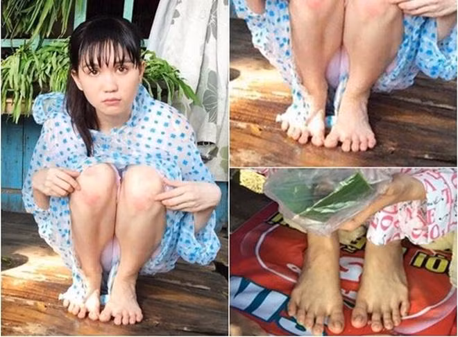 Đóng góp vào bộ sưu tập nhược điểm không thể sửa tiếp theo của Ngọc Trinh là đôi chân. Nhiều lần mẫu nội y bị chê bàn chân xương xẩu.