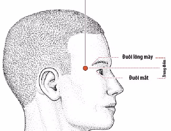 Huyệt Thái Dương thấp lõm. Huyệt Thái Dương chính là vị trí cung Phu Thê, nằm cạnh 2 đuôi mắt. Huyệt Thái Dương đầy đặn thì tài phúc vẹn toàn, cuộc sống giàu có cả về vật chất và tinh thần. Huyệt Thái Dương thấp lõm thì công danh sự nghiệp trắc trở, thiếu may mắn trong cuộc sống, tài lộc đến rồi lại đi, khó tụ. 