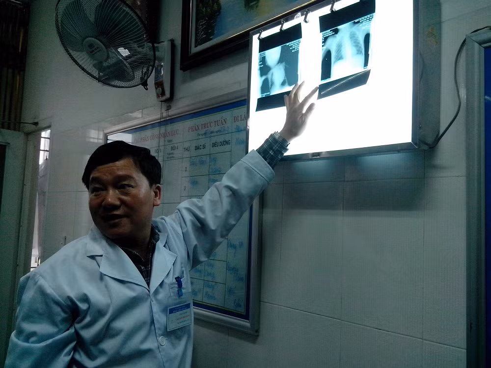 BS. Nguyễn Văn Hùng đang chiếu lại phim chụp tim của bệnh nhi Vũ Đinh Tường Vi