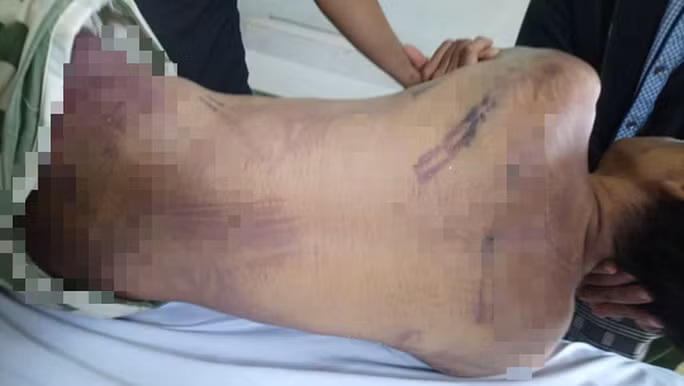 Cong an tinh Ba Ria-Vung Tau thong tin vu pham nhan bi danh chet trong trai giam