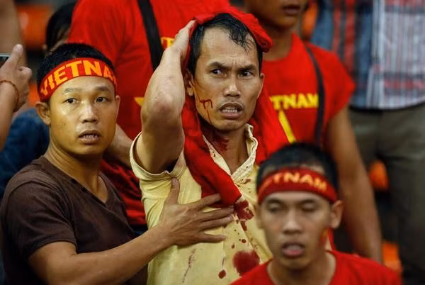 Hình ảnh CĐV Việt Nam bê bết máu khi bị CĐV Malaysia tấn công. Ảnh: Gulfnews.