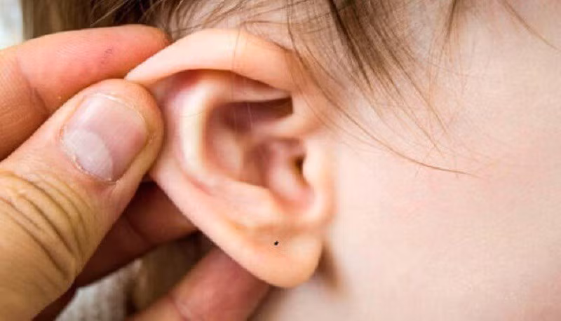 Nói chung, có một nốt ruồi trên dái tai là một điều rất may mắn, dù nó mọc ở phần nào của dái tai cũng có thể mang lại may mắn. (*Thông tin trong bài mang tính tham khảo).