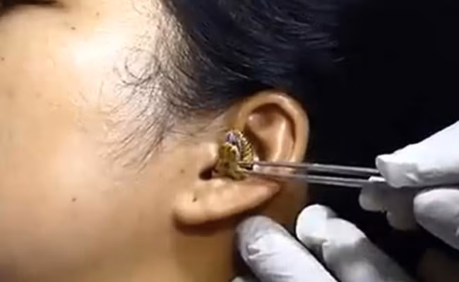 Xon xao clip ran chui vao tai nguoi khong chiu ra