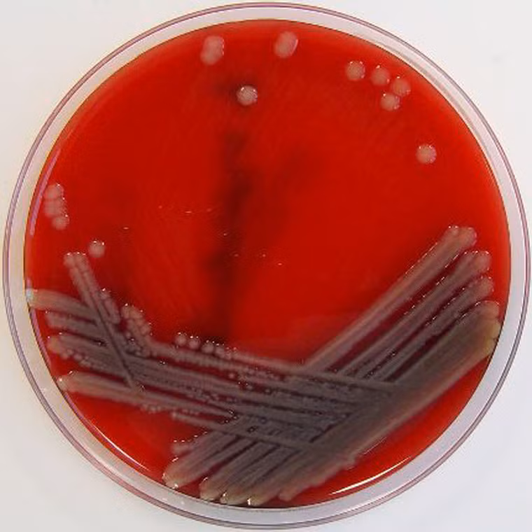 Vi khuẩn “ăn thịt người” còn được biết đến với tên khoa học là Aeromonas hydrophila dạng hình que, có 1 lớp lông quanh thân với kích thước chỉ từ 0,3 - 1 micromet, chiều ngang và dài từ 1 - 3 micromet. Vi khuẩn “ăn thịt người” sống chủ yếu trong môi trường ấm, nước bẩn và chất thải.