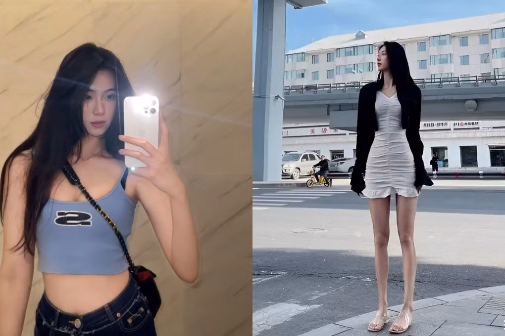 Những hình ảnh đời thường của Zhuo Shi khiến nhiều khán giả lầm tưởng cô là người mẫu bởi thân hình săn chắc, đôi chân thon dài. Tỉ lệ cơ thể của Zhuo Shi là điều khá hiếm ở các nữ vận động viên bóng rổ.