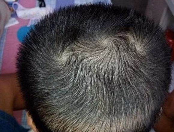 Ai co vong xoay quy tuong tren nguoi sung suong ca doi