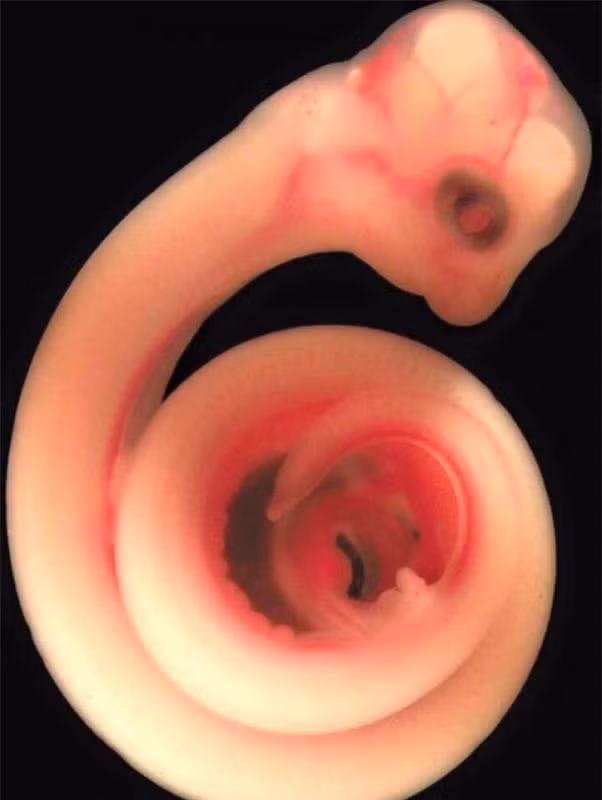 Ảnh siêu âm 4D sắc nét về động vật khi còn ở trong bụng mẹ - Hình 7 Anh sieu am 4D sac net ve dong vat khi con o trong bung me-Hinh-7
