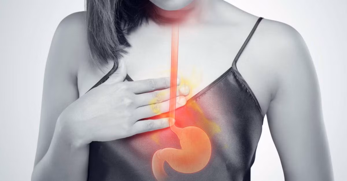 Ợ chua thường xuyên: Cảm giác nóng rát, khó chịu ở ngực thường gặp ở người lớn tuổi và có thể được điều trị bằng thuốc không kê đơn. Nhưng nếu chứng ợ nóng thường xuyên và ngày càng trầm trọng hơn hoặc không đáp ứng với thuốc, bạn có thể mắc bệnh trào ngược dạ dày thực quản (GERD), chứng rối loạn trong đó van giữa dạ dày và thực quản không đóng đúng cách. Nếu không được điều trị, GERD có thể dẫn đến các biến chứng bao gồm xói mòn hoặc thu hẹp thực quản, hoặc tình trạng tiền ung thư là Barrett thực quản. Trong một số trường hợp hiếm, chứng ợ nóng nghiêm trọng cũng có thể là dấu hiệu của ung thư thực quản hoặc thoát vị gián đoạn. Ảnh: Medicalnewstoday.