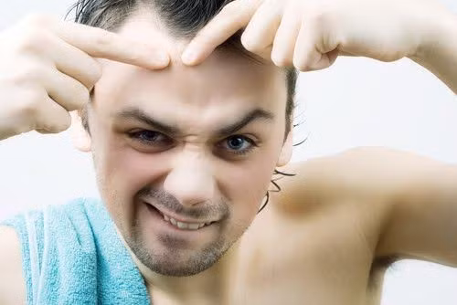 Không nặn mụn. Không nặn mụn vì nó có thể để lại sẹo và làm hỏng cấu trúc da cơ bản. Dùng sữa rửa mặt, kem trị mụn hoặc đắp mặt dạ để chăm sóc, bảo vệ làn da của bạn.