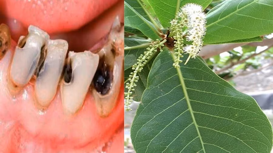 Lá bàng đun nóng: Hiệu quả từ đau răng, nhiệt miệng đến... viêm vùng kín - Hình 2 La bang dun nong: Hieu qua tu dau rang, nhiet mieng den... viem vung kin-Hinh-2
