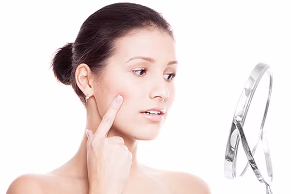 Mụn trứng cá. Là tình trạng phổ biến nổi mụn đỏ trên da do miệng tuyến bã nhờn trong cơ thể bị tắc nghẽn, hoặc tuyến bã nhờn bài tiết quá mức làm cho các chất tiết không được bài tiết kịp mà tích tụ tại lỗ chân lông, cộng thêm tác động của vi khuẩn có sẵn trong nang lông tuyến bã gây nên tình trạng mụn mủ, mụn bọc với biểu hiện sưng, nóng đỏ đau.
