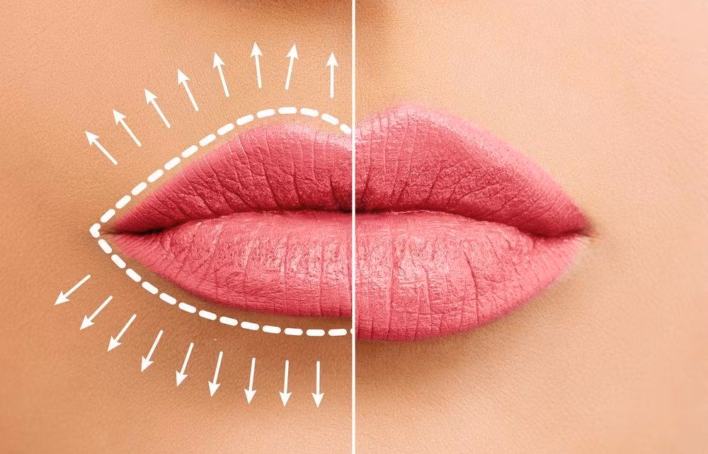  Họ thích tìm lỗi ở những khuyết điểm của người khác để mua vui và thỏa mãn cảm giác ưu việt mong manh của bản thân. Cho dù người khác có bao nhiêu ưu điểm, những người này sẽ chọn lọc bỏ qua và chỉ tập trung vào khuyết điểm của người khác. 