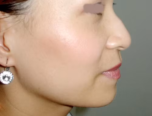 6. Phụ nữ có sống mũi gồ thường là người sống bao dung, biết thông cảm cho người khác nhưng lại hay gặp lận đận trên đường tình. Những người này tính cách thường không ổn định. Người có mũi như dao cũng là tuýp người tương tự.