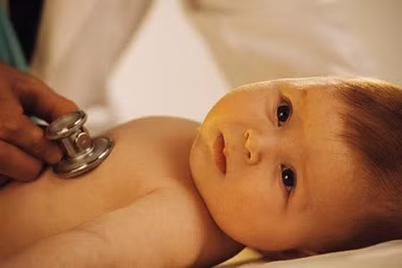 Rút lõm lồng ngực. Đây là biểu hiện của viêm phổi nặng. Để phát hiện, cha mẹ có thể nhìn vào phần dưới lồng ngực (1/3 dưới) lõm vào khi trẻ hít vào. Nếu chỉ phần mềm giữa xương sườn hoặc vùng trên xương đòn rút lõm thì không phải là rút lõm lồng ngực.