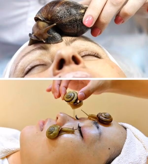Chăm sóc da mặt bằng ốc sên, Nga. Những con ốc sên được thả lên mặt bạn, và thả ra chất nhớt nhày nhụa, được cho là rất tốt cho da mặt bị tổn thương. Hình thức này xuất hiện tại các spa ở Nga, Nhật và Anh.