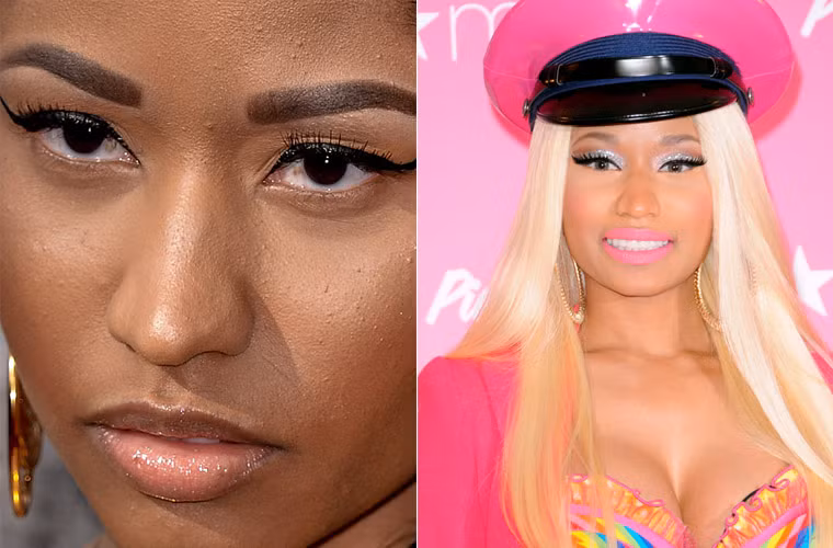 Rapper Nicki Minaj lộ rất nhiều mụn li ti trên mặt dù cô đã cố gắng trang điểm thật dày.