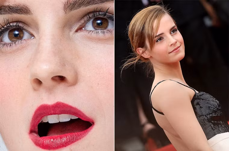 Những đốm tàn nhang trên mặt không hề làm giảm sự đáng yêu của Emma Watson.