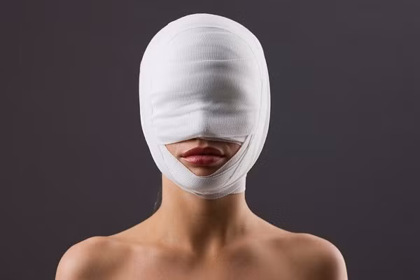 Để lại sẹo. Chúng ta vẫn thường nghĩ, đã gọi là mổ thẩm mĩ thì sẽ không để lại sẹo nhưng sự thật là sẹo buộc phải có. Vấn đề là sẹo ít hay nhiều, rõ hay không, có che giấu được ở những vùng khó thấy không! Một điều quan trọng cần lưu ý là cơ địa sẹo lồi. Trên những người này, dù cho phẫu thuật giỏi cách mấy, sẹo vẫn lồi, vẫn xấu. Nhiều trường hợp, chỉ cần một lần nặn mụn thôi, sẹo lồi đã phát triển, không ngăn được. Sẹo lồi là một "đại nạn" của phẫu thuật thẩm mĩ.