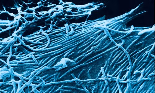 Vi rút Ebola dưới kính hiển vi.