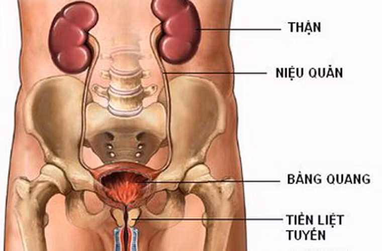 Đau bụng, đau xương chậu. Bàng quang nằm trong khu vực xương chậu. Do vậy, nếu mắc ung thư thì người bệnh dễ bị ảnh hưởng liên đới lên bụng và xương chậu.