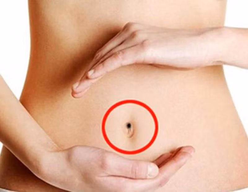 Nốt ruồi ở rốn.Trong nhân tướng học, nếu một người có nốt ruồi ở vị trí rốn thì sẽ may mắn giành phần thắng ở các cuộc đụng độ, cạnh tranh.