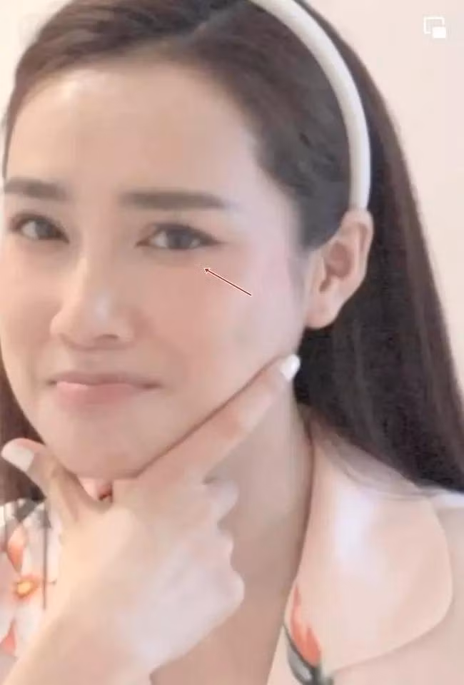 Nhã Phương từng thừa nhận nếp nhăn, bọng mắt là khuyết điểm khiến cô tự ti nhất trong một lần livestream.