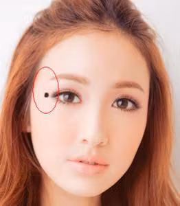 Nốt ruồi ở cung phu thê. Điều này có thể ảnh hưởng đến tình cảm lứa đôi, rất khó có nhân duyên tốt, rất dễ vì nguyên nhân từ một phía mà làm hỏng chuyện tình duyên của lứa đôi. Những người này nên chú tâm vào tình cảm.