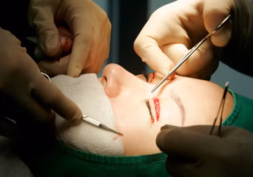 Mí mắt là nơi rất nhạy cảm, da mí mắt lại mỏng nên bất cứ sự kích ứng nào đều có thể dẫn đến chứng phù nề kéo dài và để lại sẹo xấu xí ngay tại mí mắt.