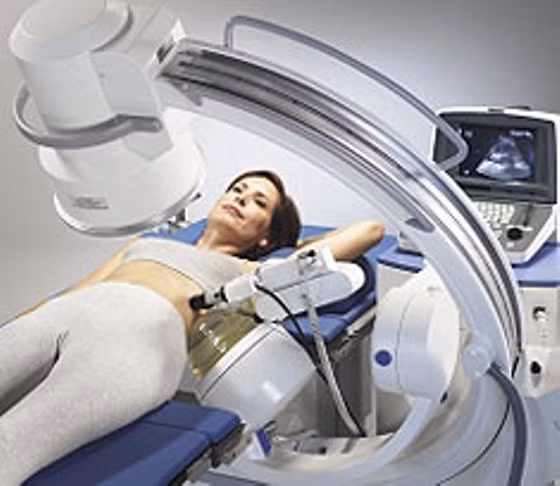 Có hai kỹ thuật được sử dụng rộng rãi ở hầu hết các cơ sở y tế. Một là bạn sẽ nằm trên một tấm nệm mềm thông qua đó các sóng xung kích sẽ đi qua. Sử dụng khoảng từ 2000 đến 8000 sóng xung kích là cần thiết để phá sỏi.