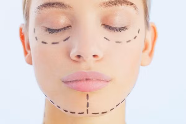 Bên cạnh đó còn có phẫu thuật chỉnh hình cằm: Phẫu thuật tạo hình cằm nhọn, cằm dài bằng phương pháp cắt trượt xương, cắt xương lồi cằm cũng thường được kết hợp trong phẫu thuật cắt góc hàm để tạo hình gương mặt trái xoan, V line.