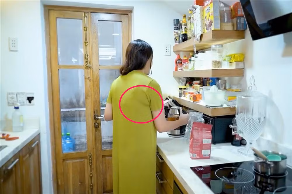 Đặc biệt, ở phía sau lưng, bà xã đại gia Đức An còn lộ khá nhiều mỡ lưng. Tất nhiên, để đánh bay toàn bộ mỡ từ một người từng nặng đến 80kg chỉ trong vòng vài tháng là việc không hề đơn giản nhưng nỗ lực ăn uống có chọn lọc, sinh hoạt điều độ cũng như tập tành thể thao đã mang lại sự chuyển biến rõ rệt với Phan Như Thảo. Hậu giảm cân, cô cũng phải đối mặt với một vài vấn đề không mong muốn như mặt hóp hơn, lộ rõ rãnh cười hoặc làn da chảy nhão chứ không được tròn căng như trước nhưng visual của mẹ bé Bồ Câu vẫn được đánh giá rất cao.