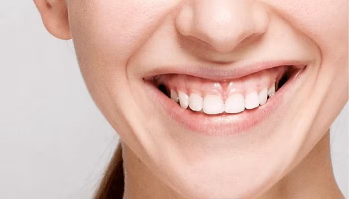 Nếu phụ nữ cười hở lợi mà lợi còn thâm, môi mỏng thì bạn nên đề phòng vì họ không trung thực, thật thà, thật khó để tìm được một người đàn ông tốt đi với mình đến hết cuộc đời. 