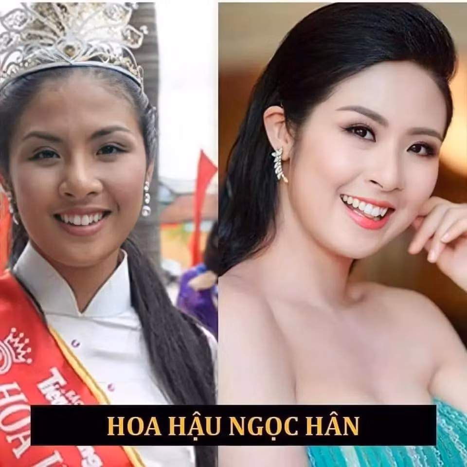 Nữ MC nổi tiếng "lột xác" sau 2 năm niềng răng - Hình 6 Nu MC noi tieng