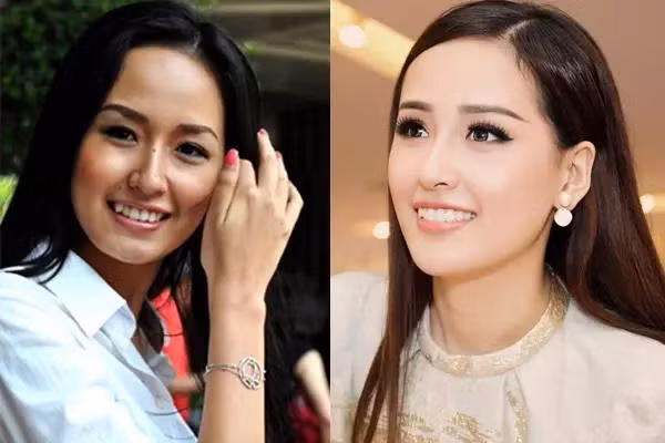 Nữ MC nổi tiếng "lột xác" sau 2 năm niềng răng - Hình 5 Nu MC noi tieng
