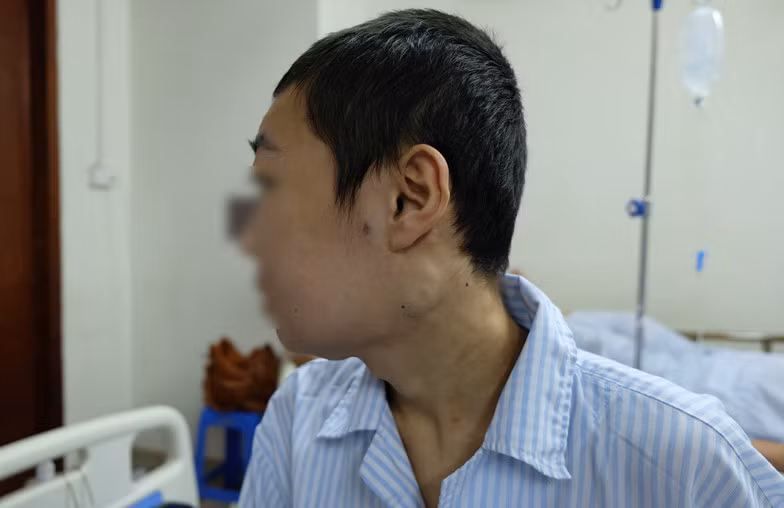 Sưng đau chân, acid uric tăng tưởng do gút, hoá ra ung thư máu Sung dau chan, acid uric tang tuong do gut, hoa ra ung thu mau